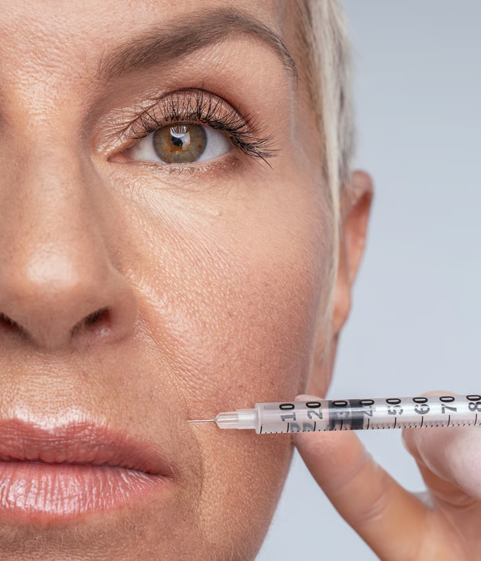 Preenchimento com ácido hialurônico 