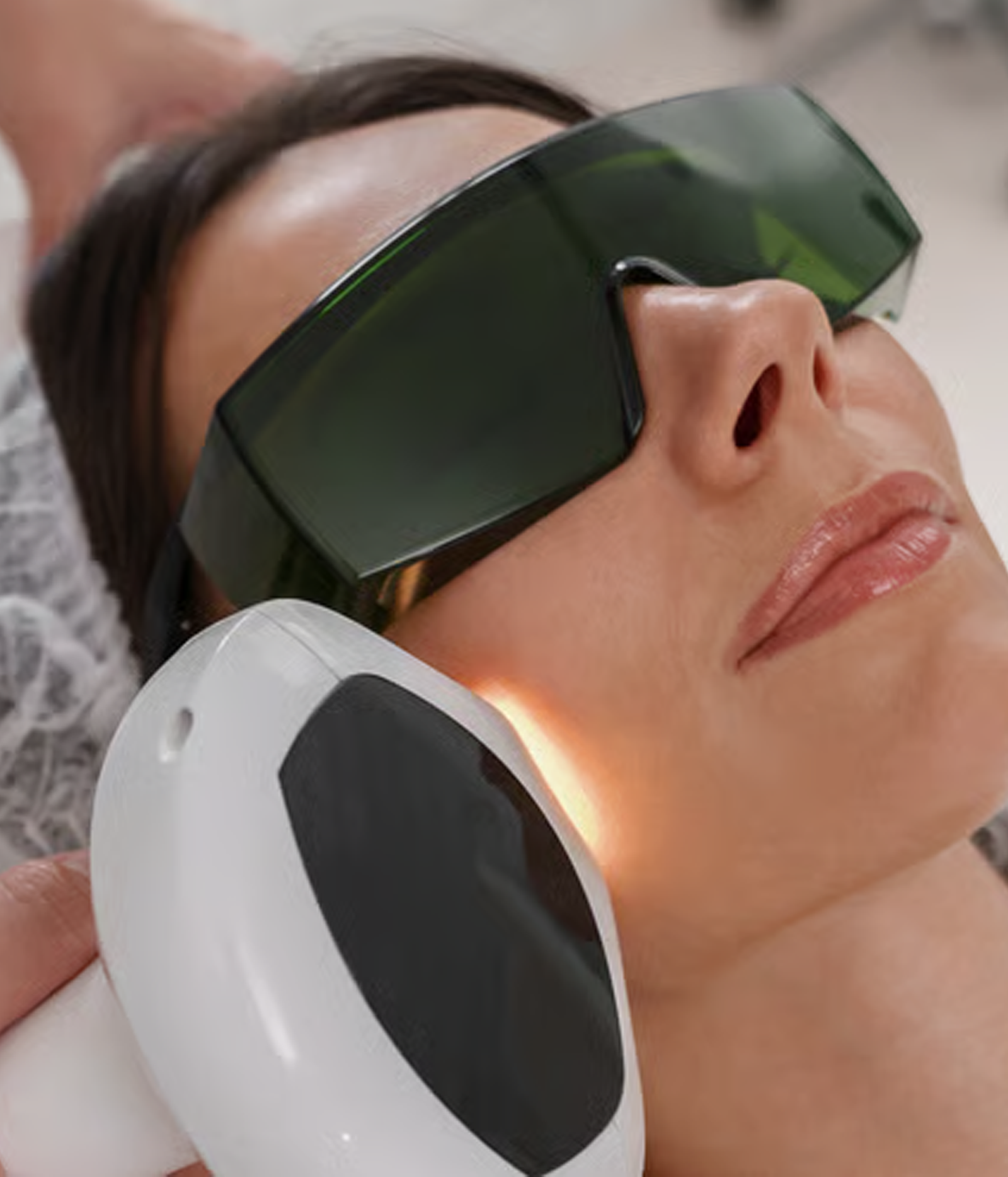 Luz intensa pulsada (LIP)